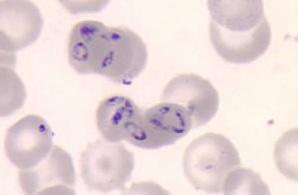Muestras celulares tintadas con presencia del parásito Babesia (imagen: laboratorio para la identificación de parásitos de interés para la salud pública, CDC-EEUU)