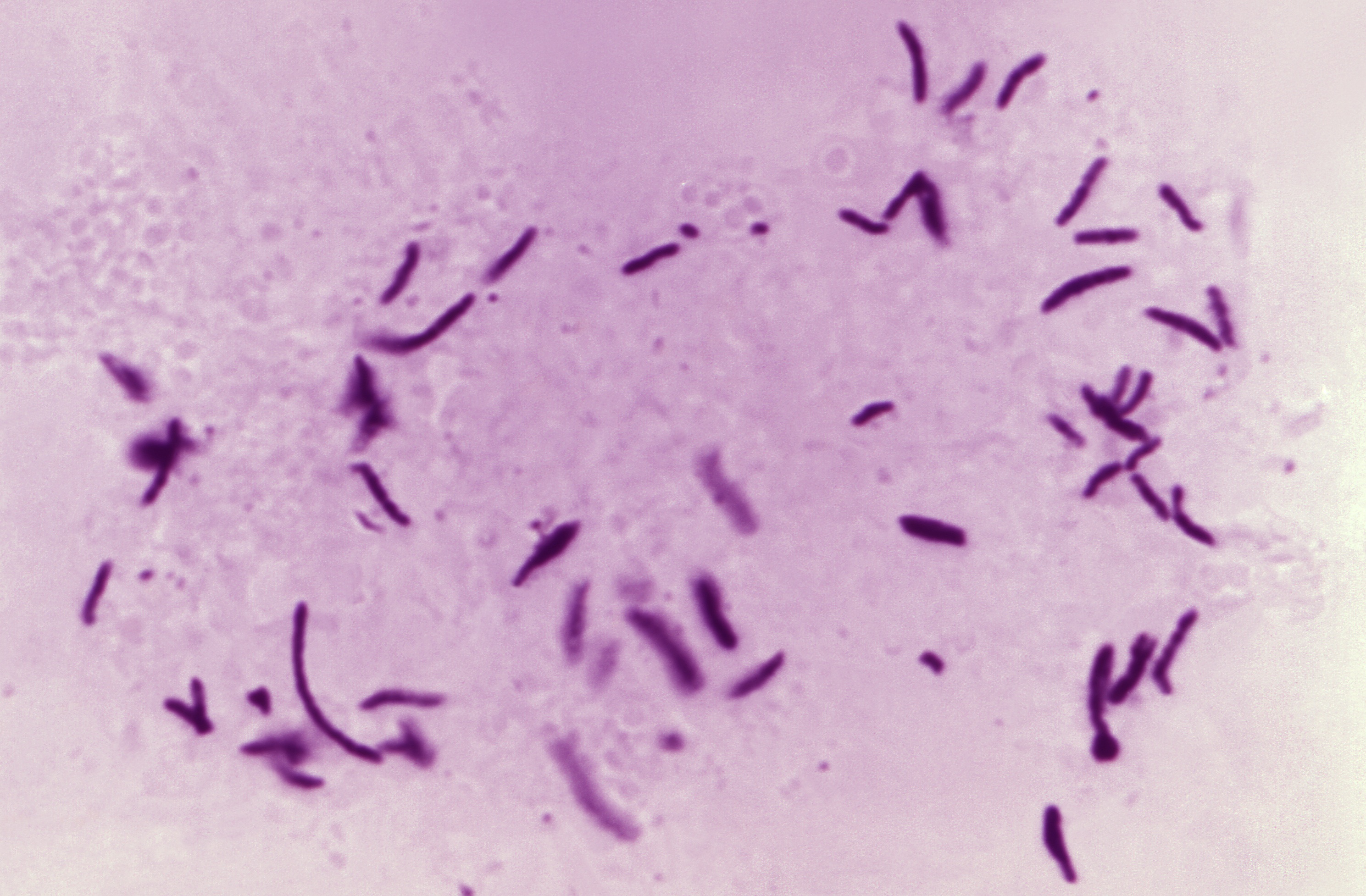 Imagen al microscopio de 'Mycobacterium tuberculosis', la bacteria causante de la tuberculosis, enfermedad que también puede transmitirse de animales a personas, originándose de otras bacterias del llamado Complejo Mycobacterium tuberculosis, como 'Mycobacterium bovis' o 'Mycobacterium caprae'.